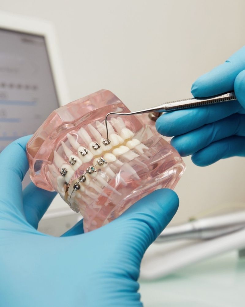 Orthodontic Dentistry Image